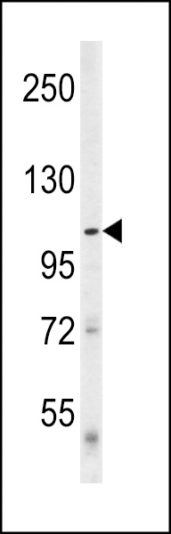 Western blot analysis of Denatured  ATG1 (Cat. #AP9117a) in mouse cerebellum tissue lysates (35ug/lane). ATG1 (arrow) was detected using the purified Pab.