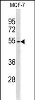 Western blot analysis of ADAMDEC1 Antibody (N-term) (Cat. #AP9119a) in MCF-7 cell line lysates (35ug/lane). ADAMDEC1 (arrow) was detected using the purified Pab.