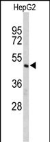 Western blot analysis of CFLAR Antibody (Center) (Cat. #AP9123c) in HepG2 cell line lysates (35ug/lane). CFLAR (arrow) was detected using the purified Pab.