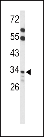 Western blot analysis of ACOT8 Antibody (C-term) (Cat. #AP9144b) in mouse liver tissue lysates (35ug/lane). ACOT8 (arrow) was detected using the purified Pab.