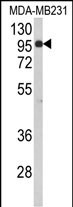 Western blot analysis of BAHD1 Antibody (C-term) (Cat. #AP9159b) in MDA-MB231 cell line lysates (35ug/lane). BAHD1 (arrow) was detected using the purified Pab.