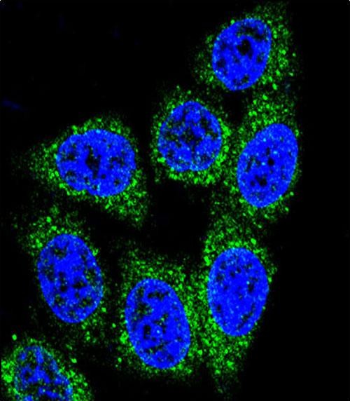 Confocal immunofluorescent analysis of MUTYH Antibody (Center) (Cat. #AP9161c) with Hela cell followed by Alexa Fluor� 488-conjugated goat anti-rabbit lgG (green). DAPI was used to stain the cell nuclear (blue).