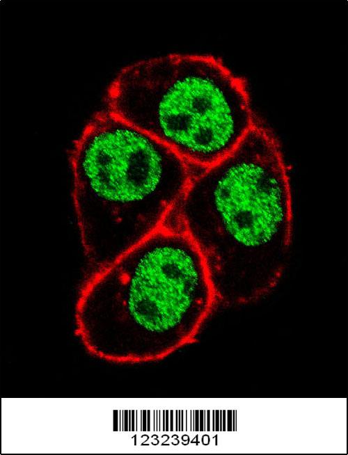 Confocal immunofluorescent analysis of CDC73 Antibody (Center)(Cat#AP9181c) with Hela cell followed by Alexa Fluor 488-conjugated goat anti-rabbit lgG (green). Actin filaments have been labeled with Alexa Fluor 555 phalloidin (red).