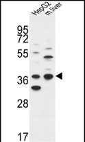 DHRS3 Antibody (Center) (Cat. #AP9188c) western blot analysis in HepG2 cell line and mouse liver tissue lysates (35ug/lane).This demonstrates the DHRS3 antibody detected the DHRS3 protein (arrow).
