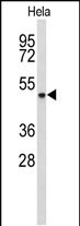 Western blot analysis of ADH6 Antibody (Center) (Cat. #AP9203c) in Hela cell line lysates (35ug/lane). ADH6 (arrow) was detected using the purified Pab.