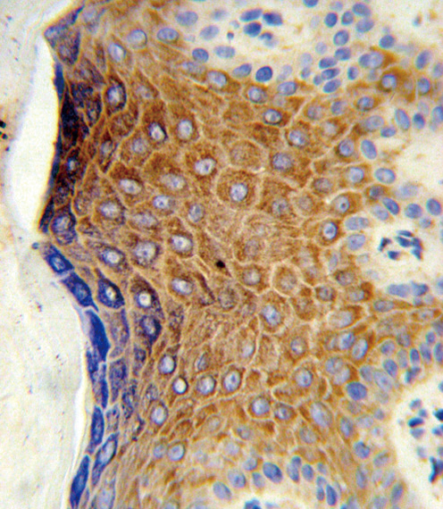IHC-P - GALNT3 Antibody (Center) AP9208C