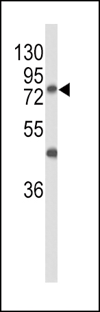 WB - GALNT3 Antibody (Center) AP9208C
