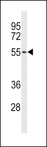 Western blot analysis of ACCN1 Antibody (Center) (Cat. #AP9213c) in NCI-H460 cell line lysates (35ug/lane). ACCN1 (arrow) was detected using the purified Pab.