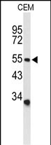 Western blot analysis of ACCN2 Antibody (C-term) (Cat. #AP9270b) in CEM cell line lysates (35ug/lane). ACCN2 (arrow) was detected using the purified Pab.