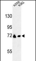 Western blot analysis of GFPT2 Antibody (Center) (Cat. #AP9282c) in A2058, K562 cell line lysates (35ug/lane). GFPT2 (arrow) was detected using the purified Pab.