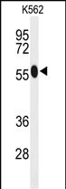 Western blot analysis of ACSM1 Antibody (N-term) (Cat. #AP9284a) in K562 cell line lysates (35ug/lane). ACSM1 (arrow) was detected using the purified Pab.