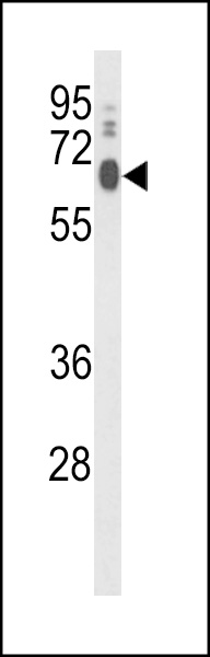 WB - PCAT1 Antibody (C-term) AP9310b