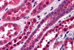 IHC - Goat Anti-Amisyn / STXBP6 Antibody AF1059a