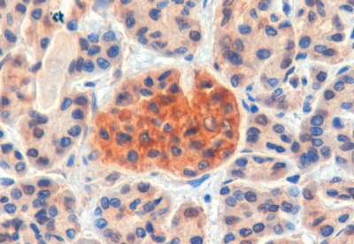 IHC - Goat Anti-CCKBR Antibody AF1209a