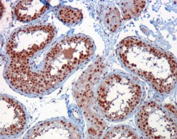 IHC - Goat Anti-RACGAP1 / MgcRacGAP Antibody AF1900a