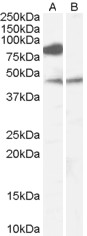 WB - Goat Anti-ZDHHC8 Antibody AF2169a