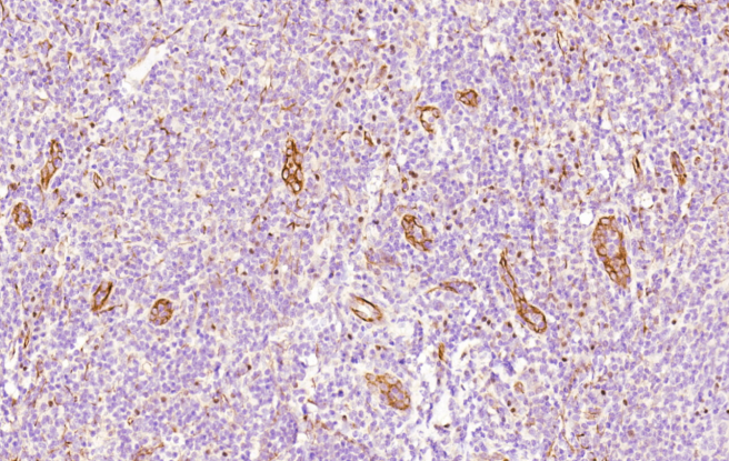 Immunohistochemical analysis of paraffin-embedded Human tonsil section using Pink1(Cat#AM1825a). AM1825a was diluted at 1:1000 dilution. A undiluted biotinylated goat polyvalent antibody was used as the secondary, followed by DAB staining.