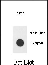 Dot blot analysis of Phospho-hE2F1-H357 Pab (Cat. #AP3698a) on nitrocellulose membrane. 50ng of Phospho-peptide or Non Phospho-peptide per dot were adsorbed. Antibody working concentrations are 0.5ug per ml.