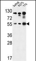 AKT1-S129 antibody (Cat. #AP7141j) western blot analysis in Jurkat,A375,Y79 cell line lysates (35ug/lane).This demonstrates the AKT1 antibody detected the AKT1 protein (arrow).