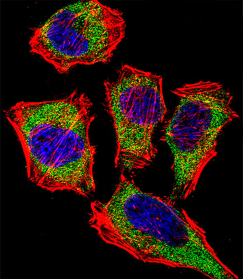 Fluorescent confocal image of Hela cell stained with CA2 Antibody (N-term)(Cat#AP7307a).Hela cells were fixed with 4% PFA (20 min), permeabilized with Triton X-100 (0.1%, 10 min), then incubated with CA2 primary antibody (1:25, 1 h at 37?). For secondary antibody, Alexa Fluor� 488 conjugated donkey anti-rabbit antibody (green) was used (1:400, 50 min at 37?).Cytoplasmic actin was counterstained with Alexa Fluor� 555 (red) conjugated Phalloidin (7units/ml, 1 h at 37?). Nuclei were counterstained with DAPI (blue) (10 �g/ml, 10 min). CA2 immunoreactivity is localized to Cytoplasm significantly.