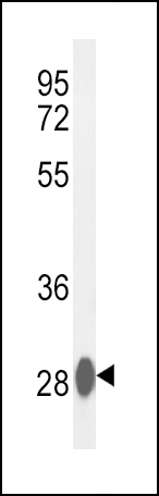 Western blot analysis of CA3 Antibody (Center) (Cat. #AP7633c) in mouse liver tissue lysates (35ug/lane). CA3 (arrow) was detected using the purified Pab.