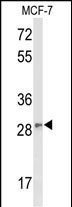 Western blot analysis of DAGLB Antibody (Center) (Cat. #AP9323c) in MCF-7 cell line lysates (35ug/lane). DAGLB (arrow) was detected using the purified Pab;