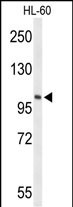 Western blot analysis of LIPE Antibody (C-term) (Cat. #AP9376b) in HL-60 cell line lysates (35ug/lane). LIPE (arrow) was detected using the purified Pab.