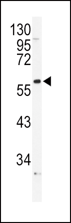 WB - ADRA1B Antibody (Center) AP9404c