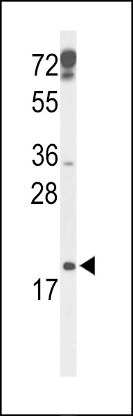 Western blot analysis of p19 Antibody (N-term) (Cat. #AP9406a) in mouse testis tissue lysates (35ug/lane). p19 (arrow) was detected using the purified Pab.
