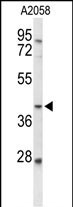 Western blot analysis of FUT3 Antibody (C-term) (Cat. #AP9410b) in A2058 cell line lysates (35ug/lane). FUT3 (arrow) was detected using the purified Pab.