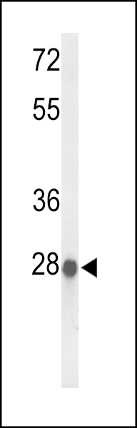 Western blot analysis of ABHDB Antibody (Center) (Cat. #AP9420c) in MCF-7 cell line lysates (35ug/lane). ABHDB (arrow) was detected using the purified Pab.
