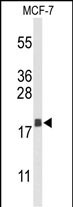 Western blot analysis of AGR3 Antibody (C-term) (Cat. #AP9424b) in MCF-7 cell line lysates (35ug/lane). AGR3 (arrow) was detected using the purified Pab.