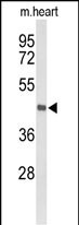 WB - DBC1 Antibody (N-term) AP9464a
