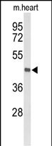 Western blot analysis of DBC1 Antibody (N-term) (Cat. #AP9464a) in mouse heart tissue lysates (35ug/lane). DBC1 (arrow) was detected using the purified Pab.