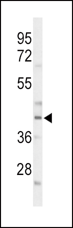 Western blot analysis of CEBPA Antibody (C-term) (Cat. #AP9477b) in mouse liver tissue lysates (35ug/lane). CEBPA (arrow) was detected using the purified Pab.
