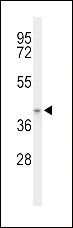 Western blot analysis of ACAD8 Antibody (Center) (Cat. #AP9488c) in mouse stomach tissue lysates (35ug/lane). ACAD8 (arrow) was detected using the purified Pab.