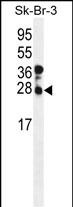 Western blot analysis of CHMP4B Antibody (N-term) (Cat. #AP9528a) in SK-BR-3 cell line lysates (35ug/lane).CHMP4B (arrow) was detected using the purified Pab.