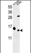 WB - RPL37 Antibody (C-term) AP9565b
