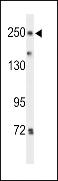 Western blot analysis of PTPRD Antibody (N-term) (Cat. #AP9589a) in Hela cell line lysates (35ug/lane). PTPRD (arrow) was detected using the purified Pab.