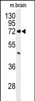Western blot analysis of ABCD2 Antibody (Center) (Cat. #AP9627c) in mouse brain tissue lysates (35ug/lane). ABCD2 (arrow) was detected using the purified Pab.