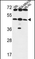 B3GNT5 Antibody (Center) (Cat. #AP9649c) western blot analysis in 293,MDA-MB435,HL-60 cell line lysates (35ug/lane).This demonstrates the B3GNT5 antibody detected the B3GNT5 protein (arrow).