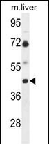 WB - B3GNT5 Antibody (Center) AP9649c