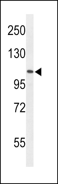 Western blot analysis of AF5q31 Antibody (N-term) (Cat. #AP9688a) in HL-60 cell line lysates (35ug/lane). AF5q31 (arrow) was detected using the purified Pab.