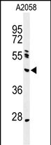 Western blot analysis of NEIL1 Antibody (Center) (Cat. #AP9696c) in A2058 cell line lysates (35ug/lane). NEIL1 (arrow) was detected using the purified Pab.