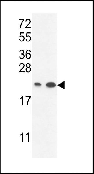 ABHEB Antibody (C-term) (Cat. #AP9700b) western blot analysis in A2058,T47D cell line lysates (35ug/lane).This demonstrates the ABHEB antibody detected the ABHEB protein (arrow).