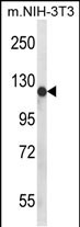 Western blot analysis of PIGN Antibody (N-term) (Cat. #AP9751a) in mouse NIH-3T3 cell line lysates (35ug/lane). PIGN (arrow) was detected using the purified Pab.