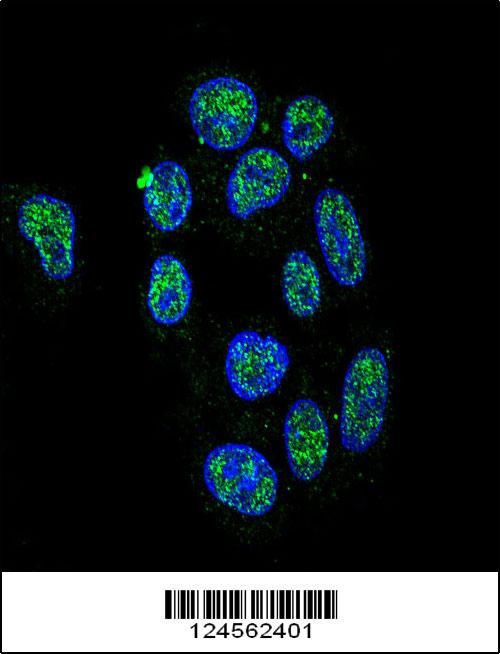 Confocal immunofluorescent analysis of ZNF202 Antibody (Center) (Cat#AP9774c) with HepG2 cell followed by Alexa Fluor 488-conjugated goat anti-rabbit lgG (green). DAPI was used to stain the cell nuclear (blue).