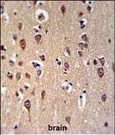 GRPR Antibody (Center) (Cat. #AP9790c) IHC analysis in formalin fixed and paraffin embedded brain tissue followed by peroxidase conjugation of the secondary antibody and DAB staining.  This data demonstrates the use of the GRPR Antibody (Center) for immunohistochemistry.  Clinical relevance has not been evaluated.