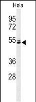 Western blot analysis of K2C78 Antibody (Center) (Cat. #AP9856c) in Hela cell line lysates (35ug/lane). K2C78 (arrow) was detected using the purified Pab.