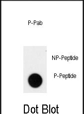 Dot blot analysis of anti-Phospho-ACK1-pY826 Phospho-specific Pab (Cat. #AP3702a)  on nitrocellulose membrane. 50ng of Phospho-peptide or Non Phospho-peptide per dot were adsorbed. Antibody working concentrations are 0.5ug per ml.